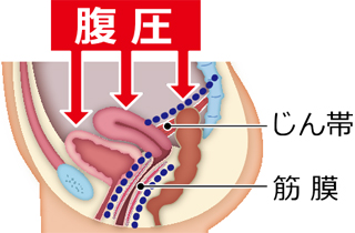 脆弱化する支持組織の部位