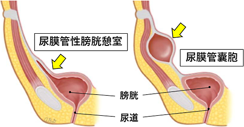 Blichert-Toft の分類