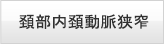頚部内頚動脈狭窄