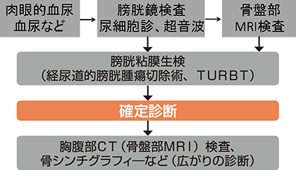 膀胱がんの診断の流れ