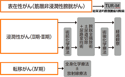 膀胱がんのタイプ別治療法