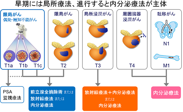 早期には局所療法，進行すると内分泌療法が主体
