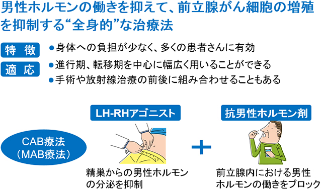 男性ホルモンの働きを抑えて，前立腺がん細胞の増殖を抑制する“全身的”な治療法