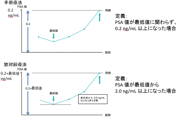 前立腺がんの治療後再発の定義
