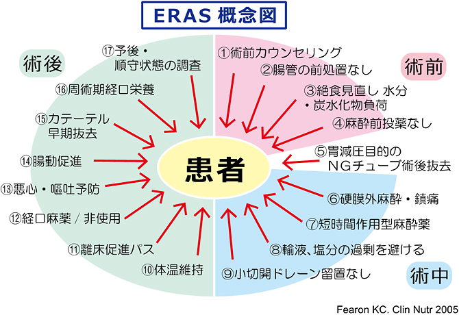 EARS概念図