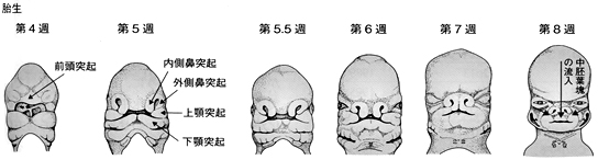 図1 唇顎口蓋裂の成り立ち