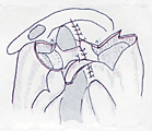 図3-3　鼻孔底形成